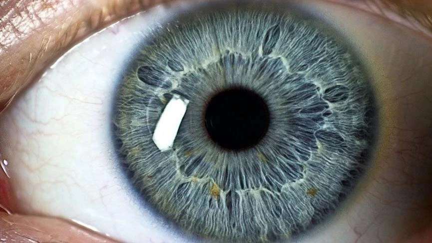 Astigmat Nedir?, Astigmat Olup Olmadığımı Nasıl Anlarım?