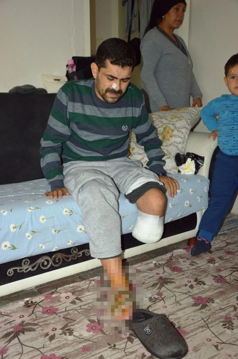 Yaşarken çürümeye başladı