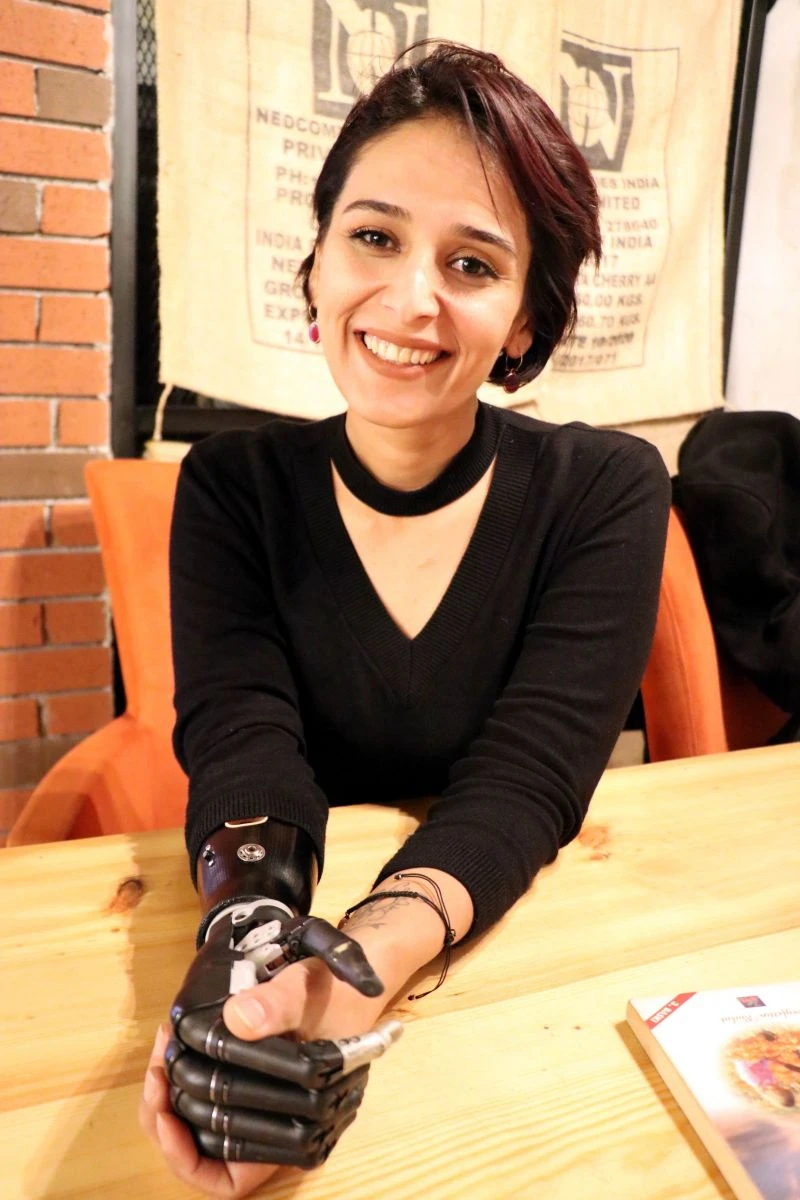 Biyonik kolla hayata tutundu