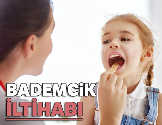 Kriptik Tonsillit, Bademcik İltihabı Nedir Nasıl Geçer