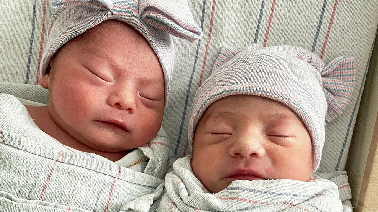 Doktorları şaşkına çeviren doğum: İkizler bir yıl arayla doğdu