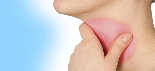 Yemek Borusunda Yanma, Yemek Borusu Yanması, Yemek Borusu Yanma Nedenleri ve Tedavisi