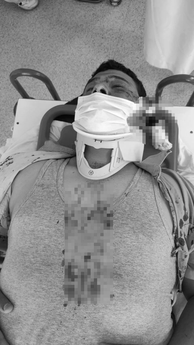 İYİ Partili Lütfü Türkkan'ın korumalarından İHA muhabirine çirkin saldırı