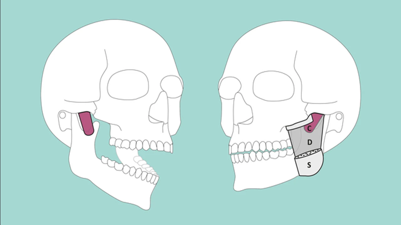 Anatomi kitapları sil baştan: Gözden kaçan yeni bir kas bulundu