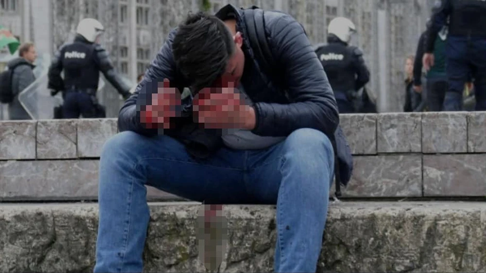 Terör örgütü sempatizanları, Belçika’da gurbetçilere saldırdı