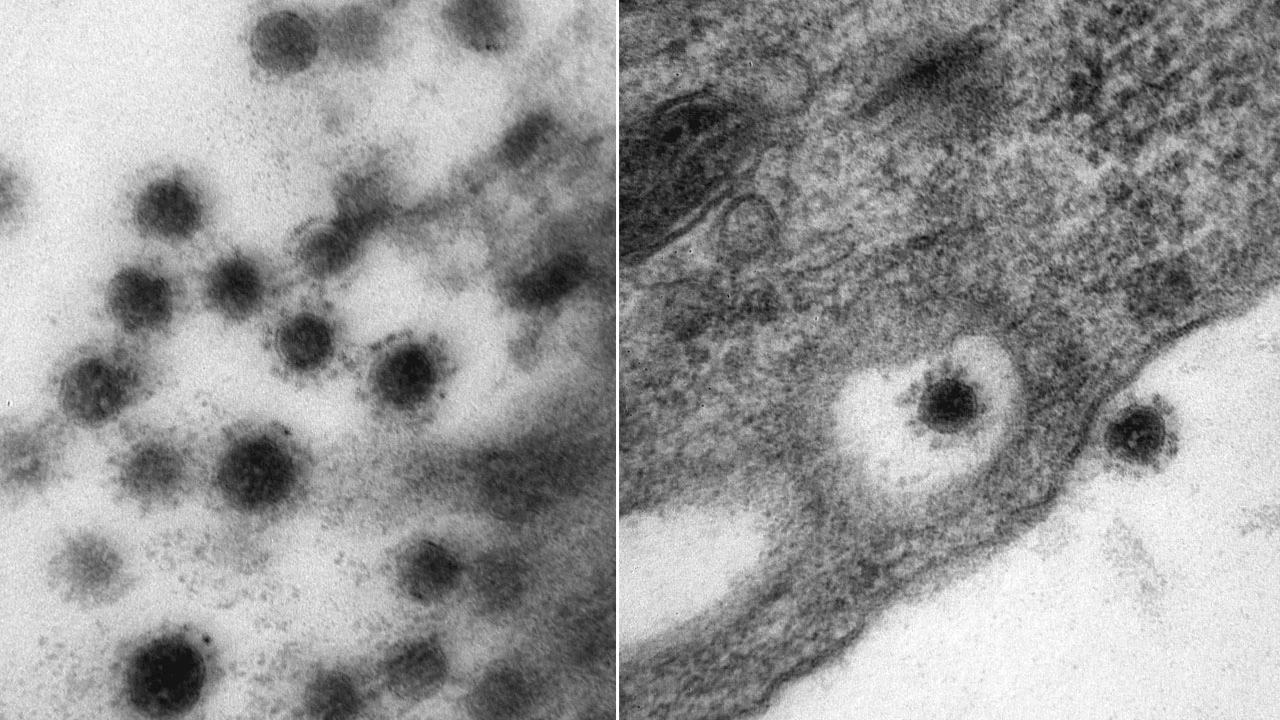 Ruslar yayınladı: Delta varyantı görüntülendi