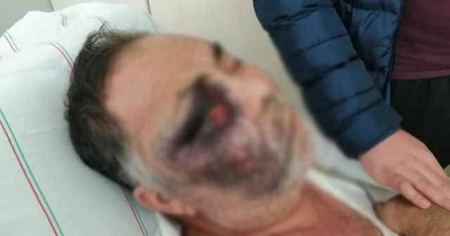 Park yeri kavgasında engelli adamı öldüresiye dövdüler