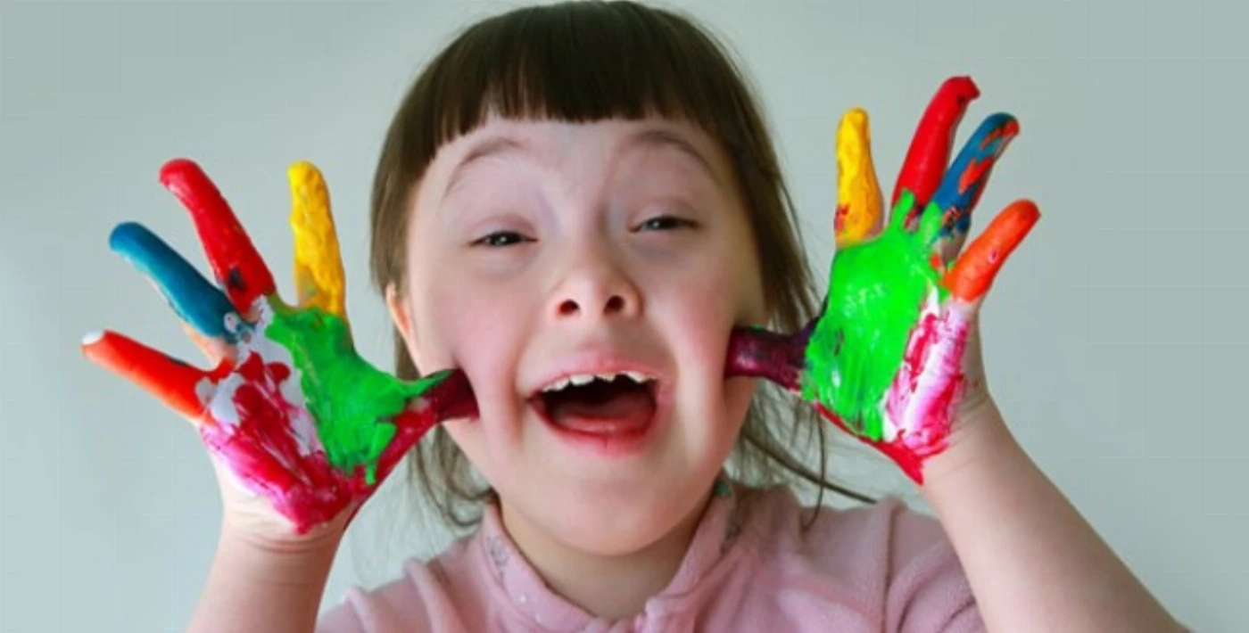 Down Sendromu Nedir? Down Sendromu Nasıl Anlaşılır? Down Sendromu Çocuklarda Nasıl Olur?