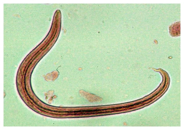 Kıl kurdu Tedavisine Sirke ve Sarımsak İyi Gelir Mi?