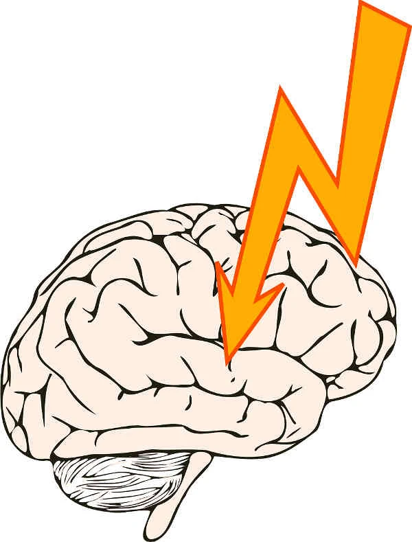 Epilepsi belirtileri nelerdir? Epilepsi çeşitleri nelerdir? Epilepsi nasıl tedavi edilir?