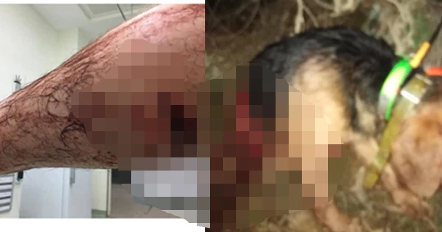 Domuz, avcıyı hastanelik etti, 20 bin liralık köpeğini öldürdü