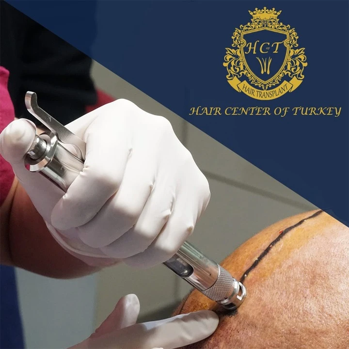 Hair Center of Turkey'de ağrısız ve tıraşsız saç ekimi ayrıcalıklarını yaşayın