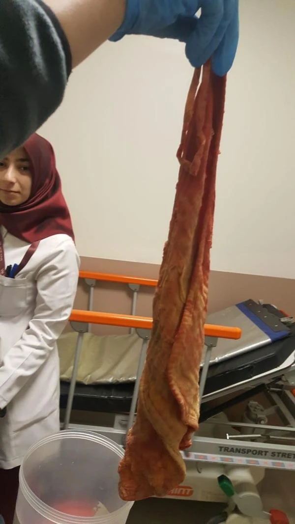 Kadının karnından çıktı! Doktorlar dehşete düştü…