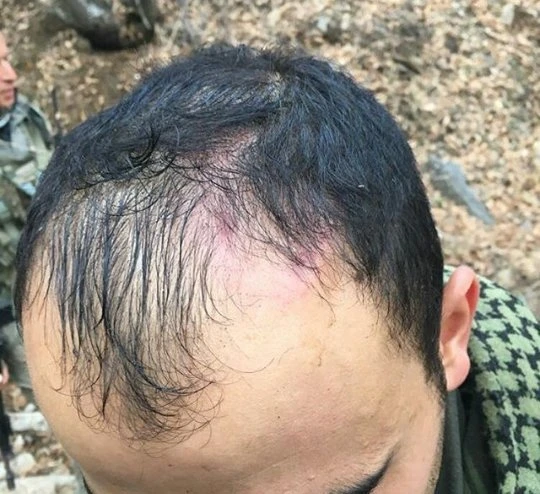 Kahraman askerlerimiz çatışmanın izlerini paylaştı