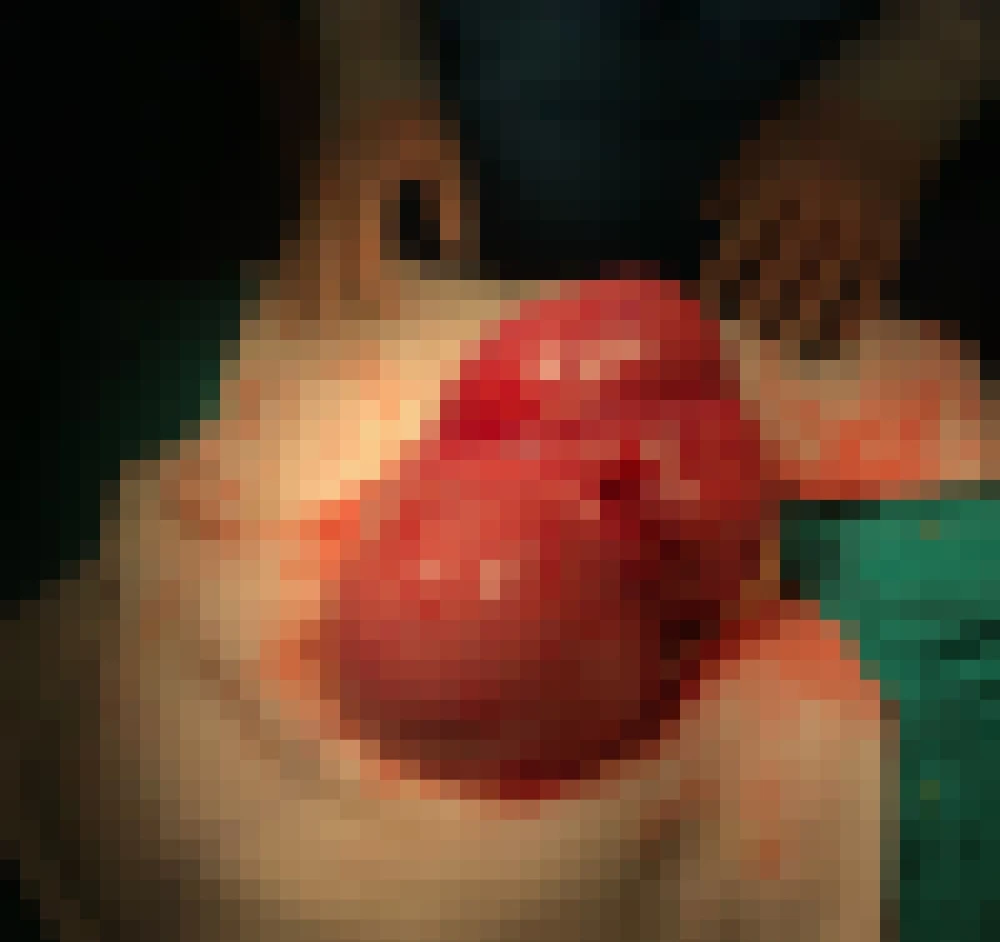 Rahminden 4 kiloluk kitle çıktı!