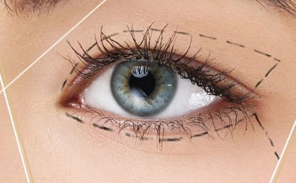Göz estetiği ile genç görünmek elinizde