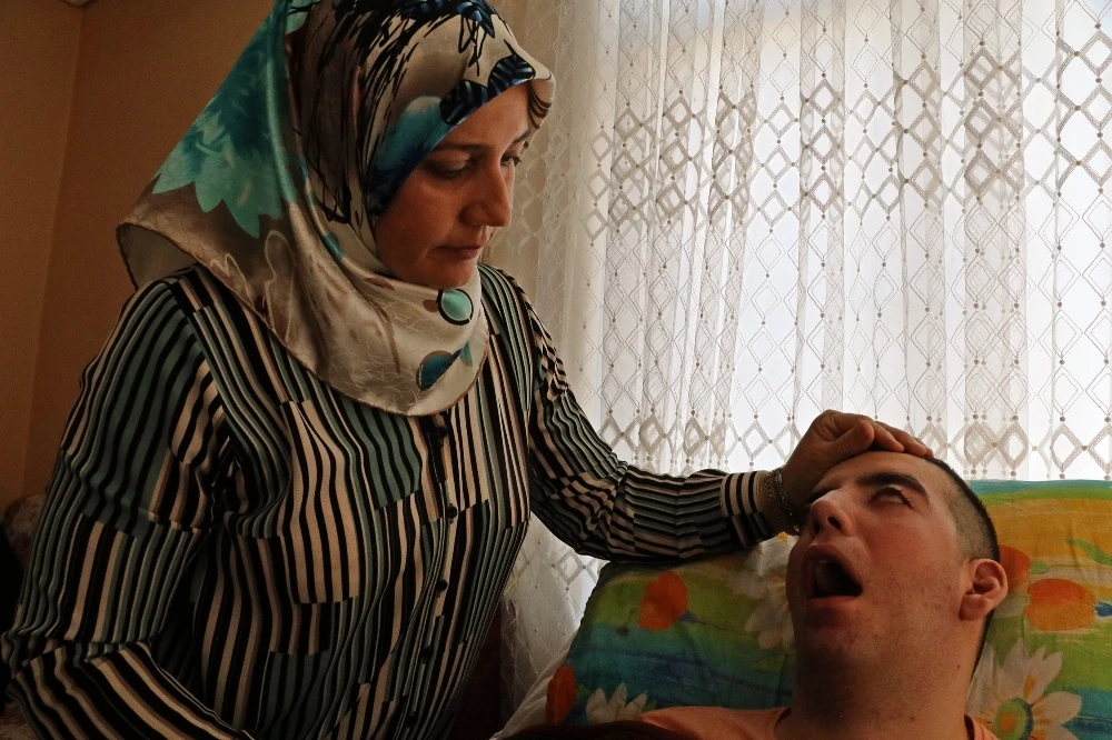 5 yıldır gözlerini kırpamıyor