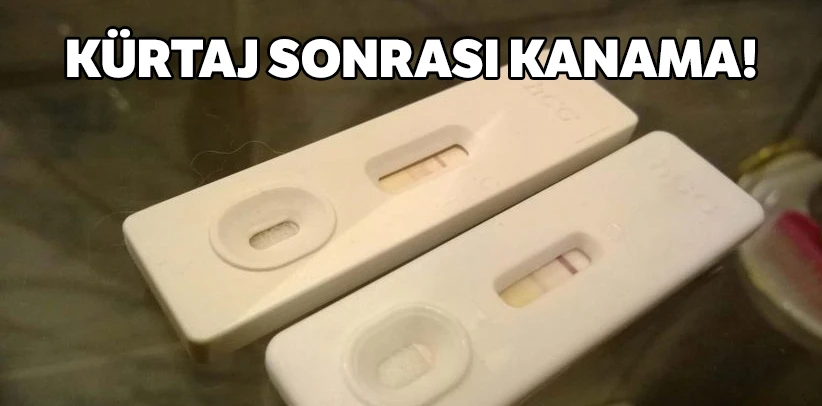 Kürtaj Sonrası Kanama! Kürtaj sonrası kanama nasıl durdurulur, Kürtajdan Sonra İyileşme Süreci