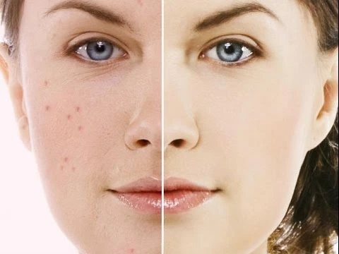 Limonun Sağlığa Faydaları ve Zararları Nelerdir?