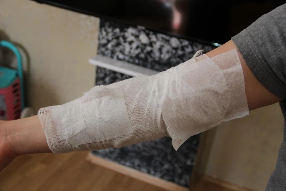 Kadına tokat attı diye uyardı, çatalla yüzünden yaralandı