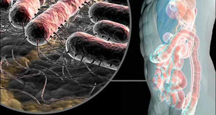 Üşütmek İdrar Yolu Enfeksiyonu Yapar mı? İdrar Yolu Enfeksiyonuna Ne İyi Gelir?