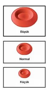 MCV Nedir, MCV Yüksekliği, MCV Düşüklüğü ve MCV Değeri kaç olmalı ?