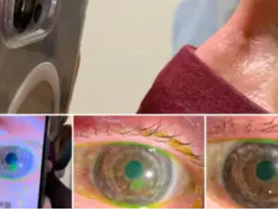 Bir doktor iPhone 13 Pro Max'i göz muayenesinde kullandı