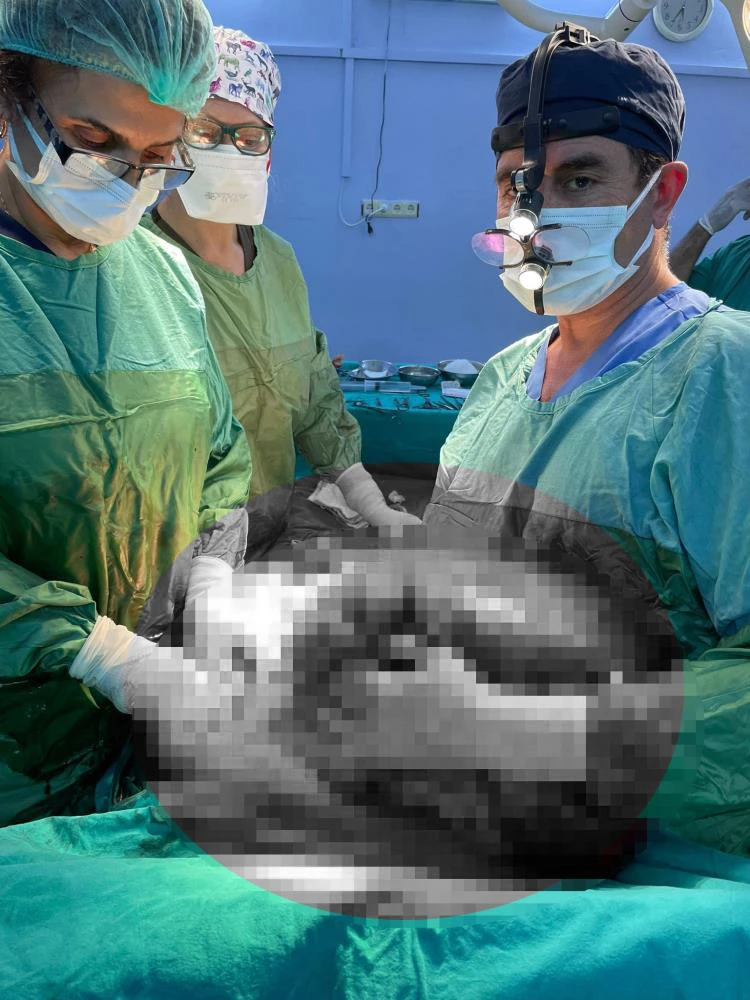 Safra kesesi şikayeti ile geldi, karnından 15 kilo tümör çıktı