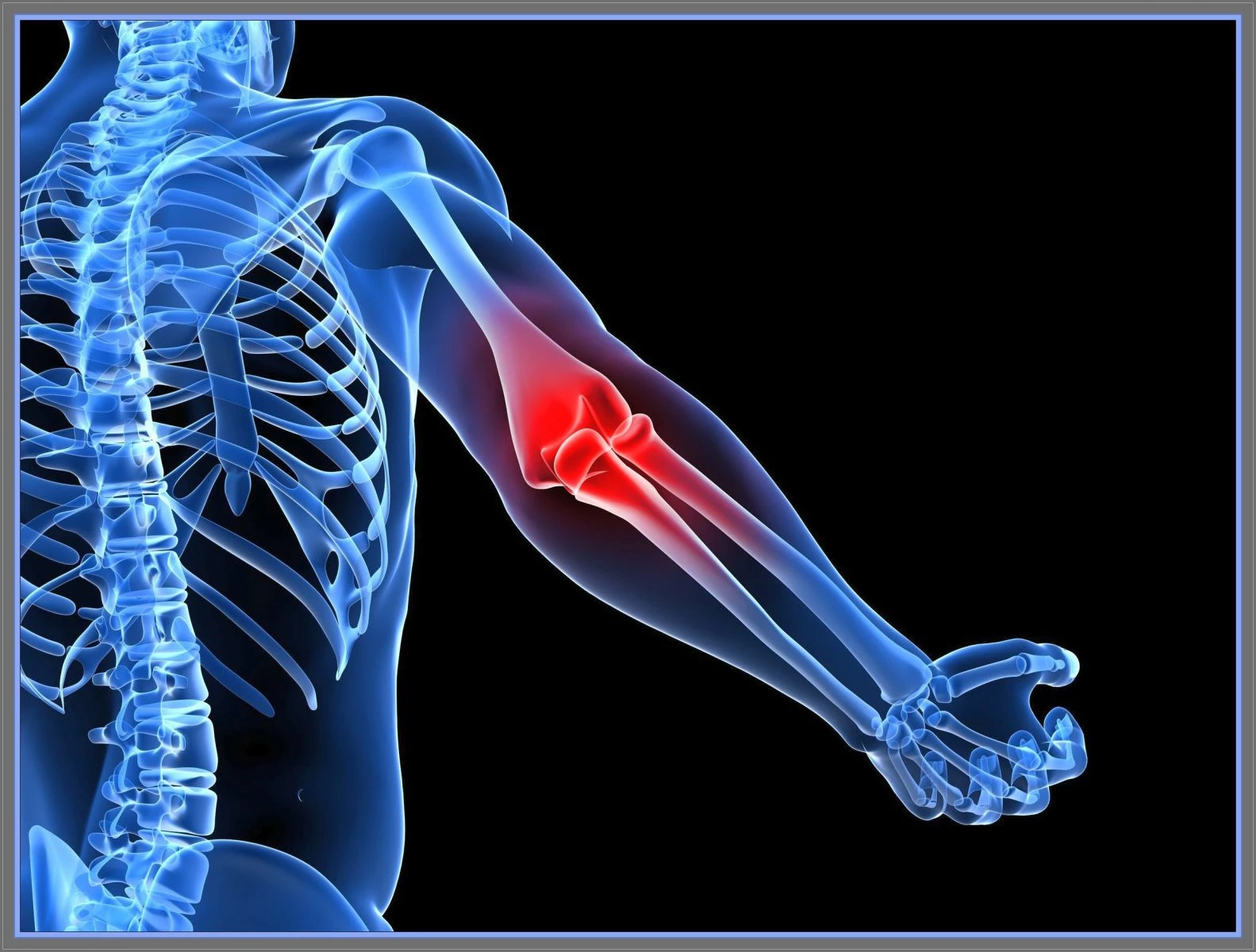 Kireçlenmeye Ne İyi Gelir? Kireçlenme Tedavisi İçin Bitkisel Çözüm Önerileri