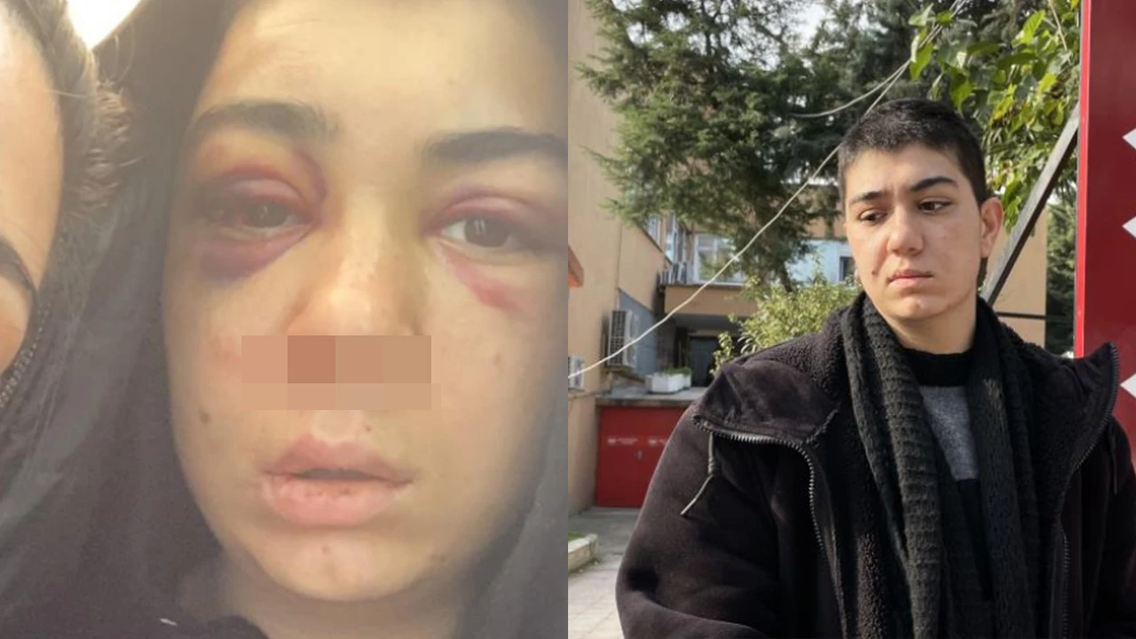 Genç kıza öldüresiye dayak kamerada! Yumruk ve tekmeler felç etti