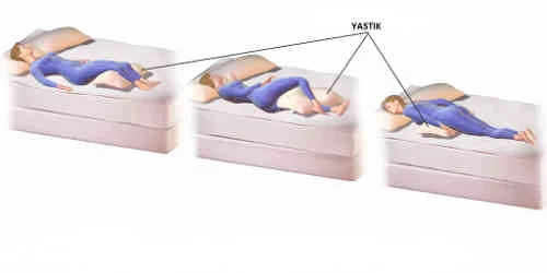 Kuyruk sokumu ağrısı neden olur nasıl geçer ne iyi gelir?