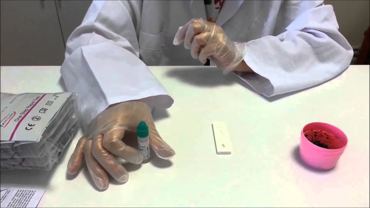 Siyah Renkli Dışkı (Melena)