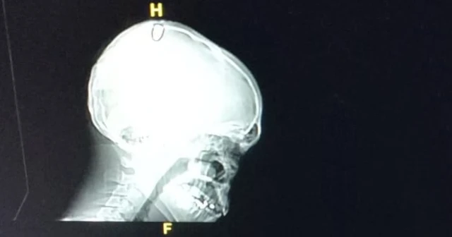 Bayram namazından çıktı kafasından vuruldu