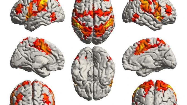 Alzheimer Hastalığı Nedir? Alzheimer Hastalığının İlk Belirtileri Nelerdir?