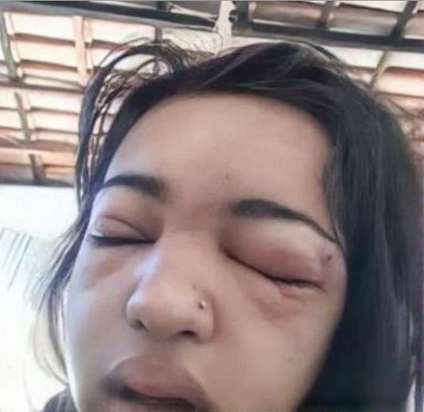 Evde kendi kaşını delen genç kız 4 kalp krizi geçirdi