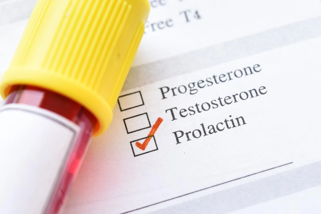 Prolaktin (prolactin) nedir? Kadınlarda prolaktin hormonu kaç olmalı?