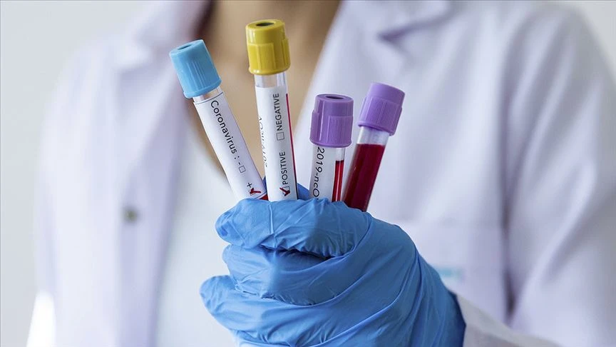 Kovid'in en uzun süreli etkileri ortaya çıktı! Beyin sisi, düşünme ve konsantre bozukluğu