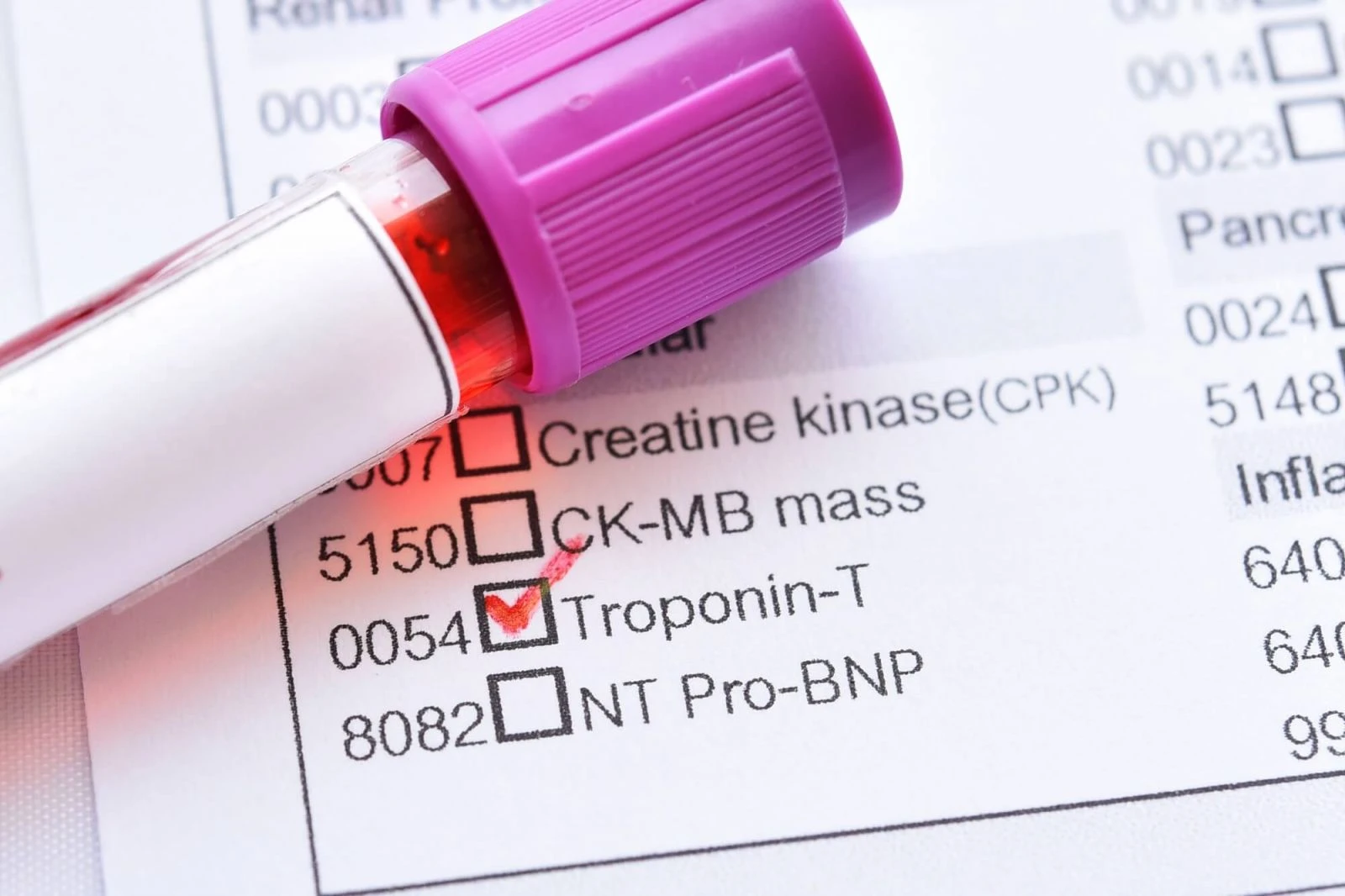 Kalp Sağlığının Anahtarı: Troponin