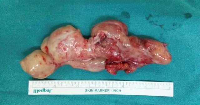 Dünya tıp tarihine geçti