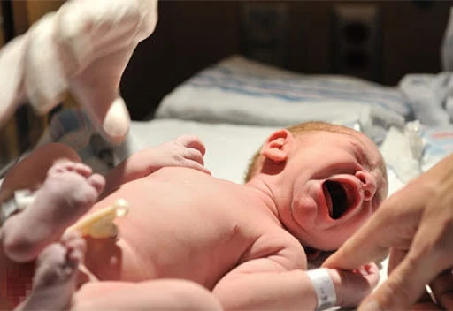 Bezli bebeklerde sünnet sonrası bakım nasıl olmalıdır? Yenidoğan bebeklerde sünnet