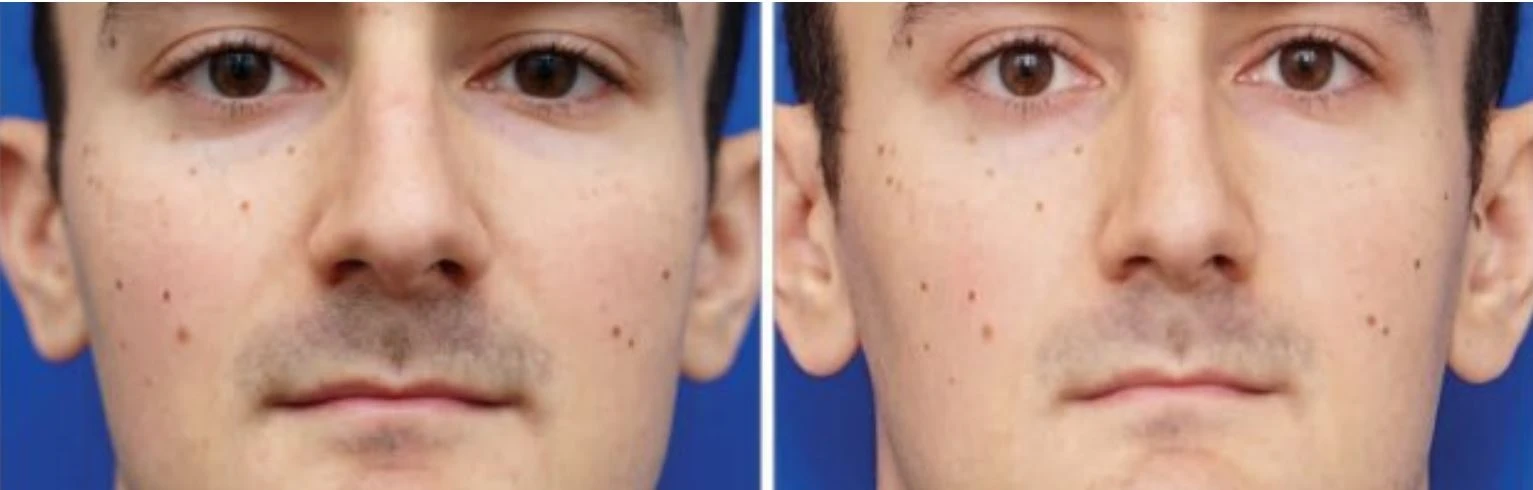 Selfie çekenler hastaneye koşuyor