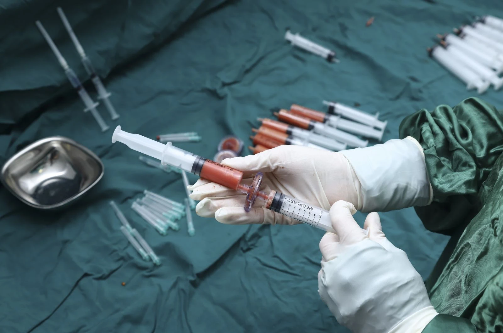 Yanık tedavisinde dünyada bir ilk: Türkiye'de uygulanıyor