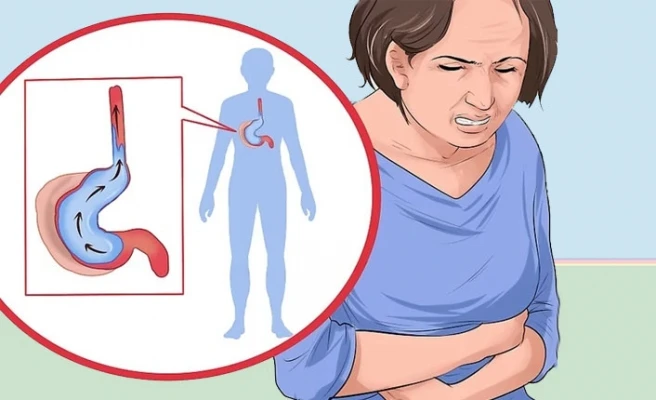 Yemek Borusunda Yanma, Yemek Borusu Yanması, Yemek Borusu Yanma Nedenleri ve Tedavisi