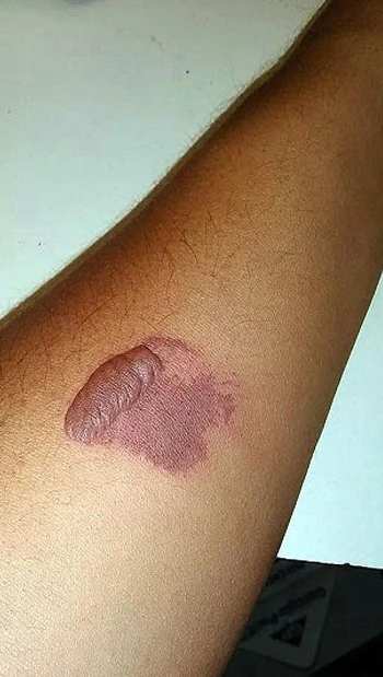 Sosyal medya çılgınlığına karşı uzmanlar uyardı