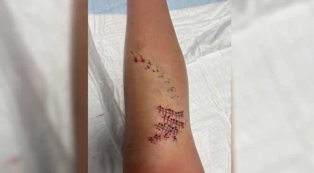 12 yaşındaki çocuk köpekbalığı saldırısından ucuz kurtuldu!