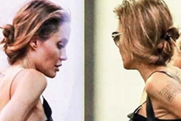 Angelina Jolie kanser mi