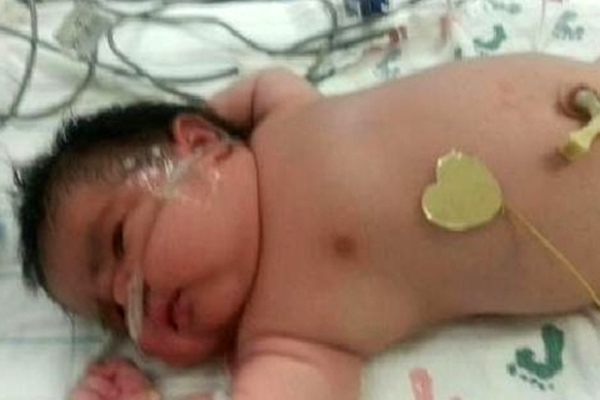 6.2 kilogram doğan bebek, görenleri şaşırttı