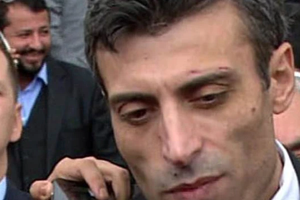 Musul Başkonsolosu Yılmaz'a alnındaki çizik soruldu