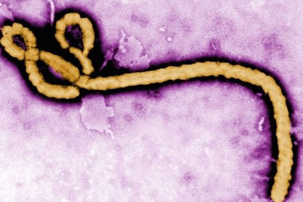 ABD&#039;li uzmanlardan &#039;Ebola&#039; açıklaması