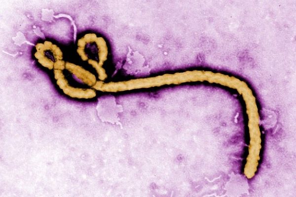 Afrika&#039;ya gideceklere &#039;Ebola&#039; uyarısı